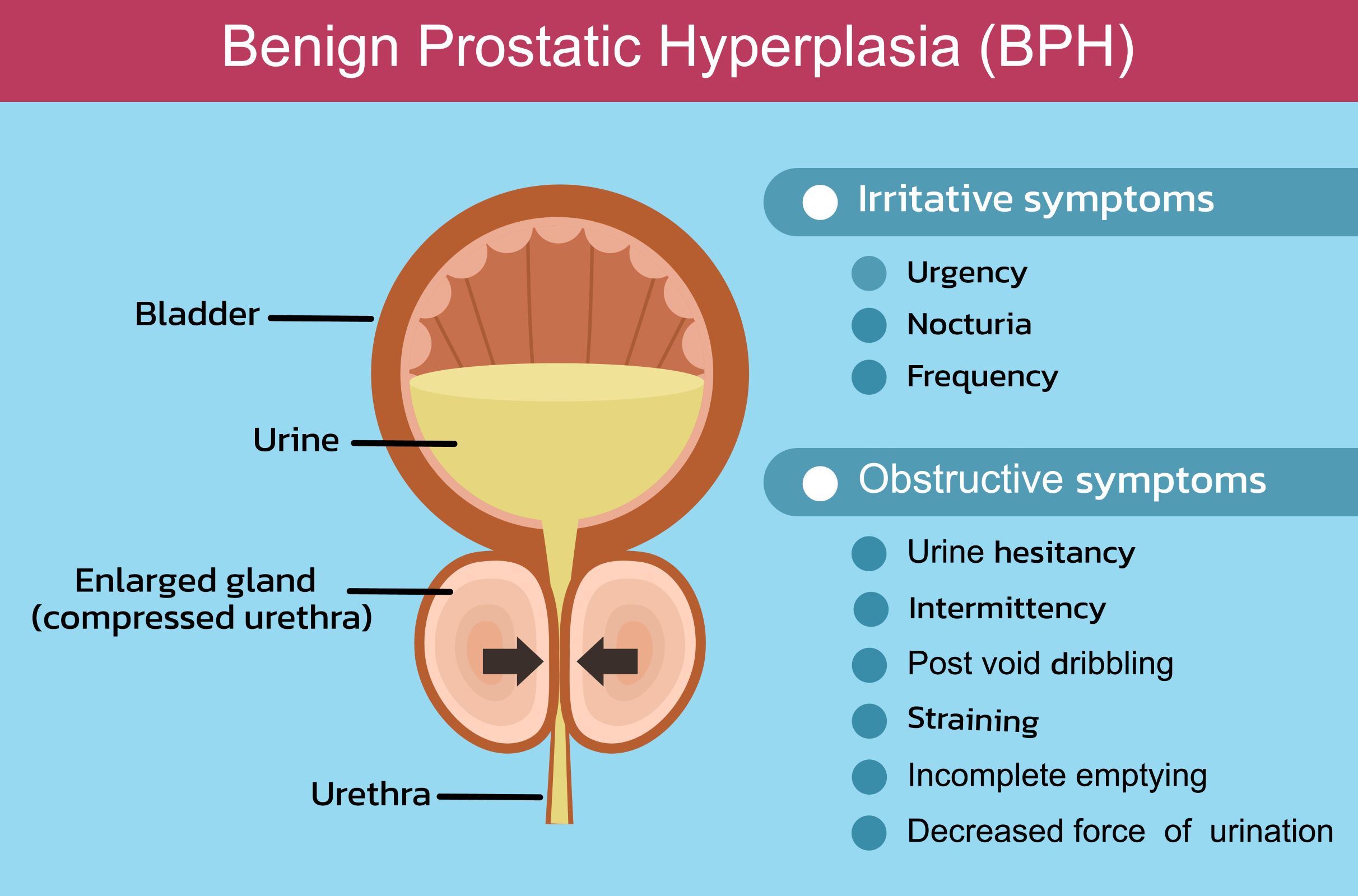 BPH graphic