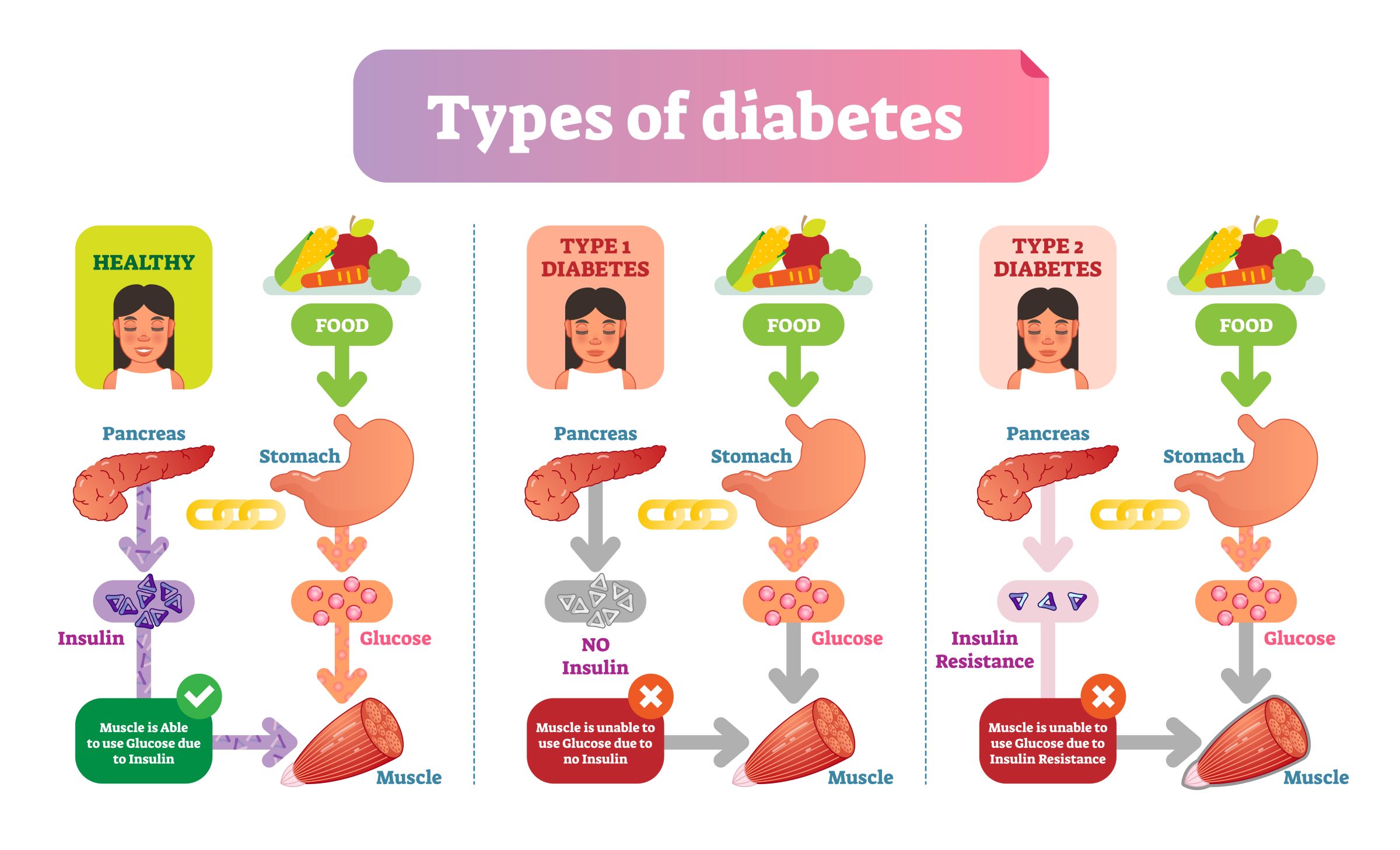 Diabetes Diagram 1 small