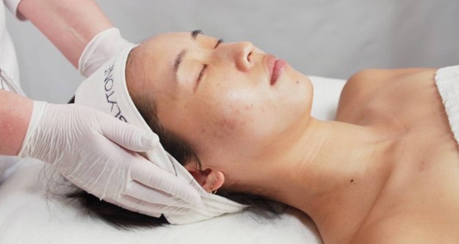 Chemical Peels Added to the List of Dermatology Services